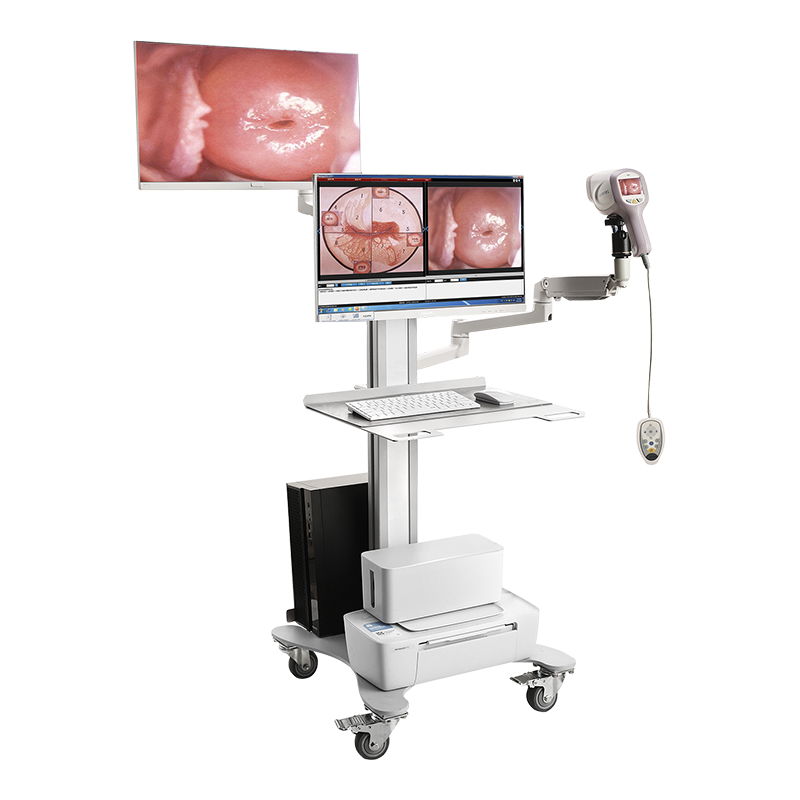 Colposcope KN-2200I(H)